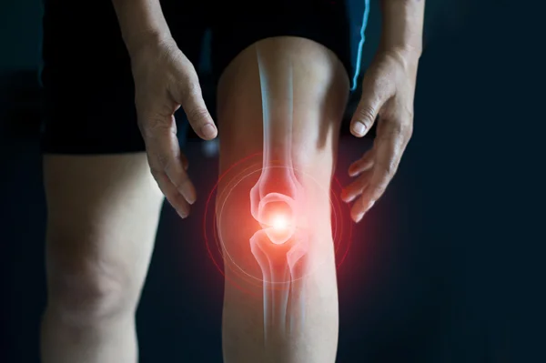 Full Arthritis Care